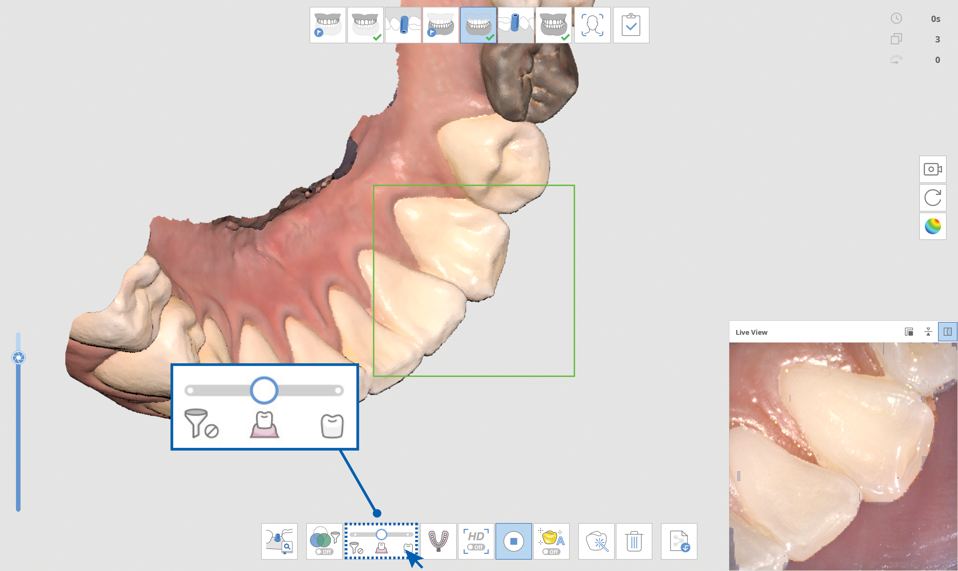 Smart Scan Filtering